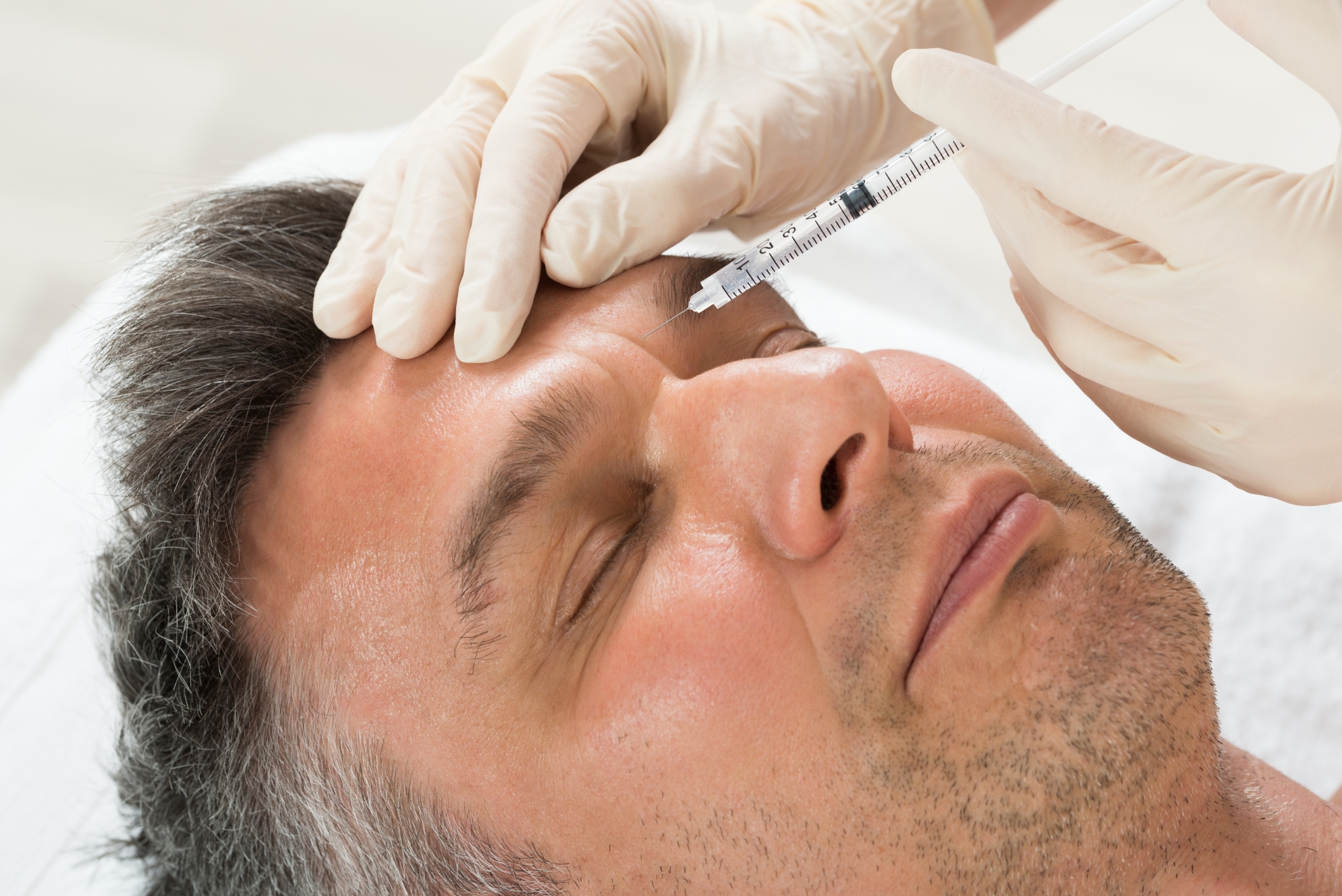 Botox Wien Stirnfalten Zornesfalte Krahenfusse Augenbrauen U V M